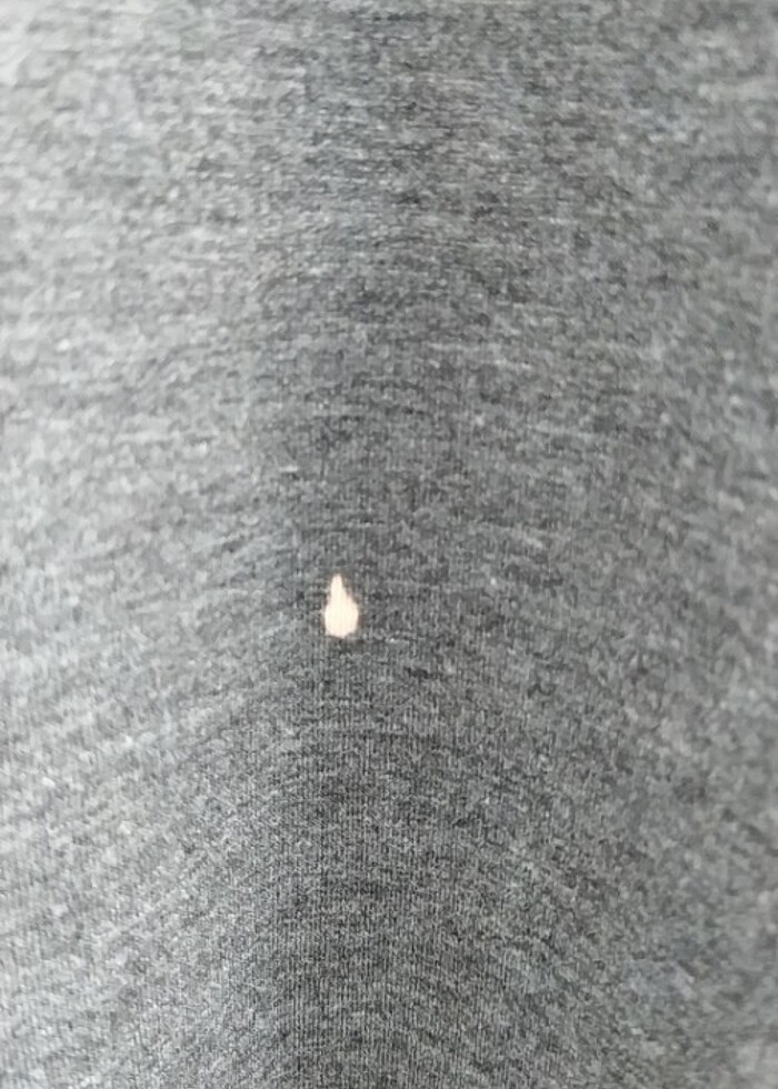 Tunikler  - Görsel 2