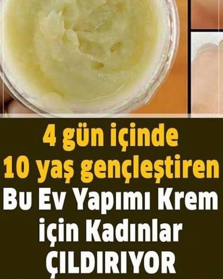VIP Botox Krem - 10 Yaş Gençleştirici - Görsel 2
