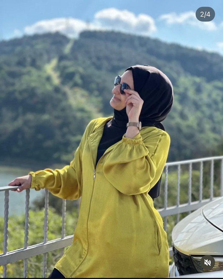 Sarı Parlak Fermuarlı Kadın Ceket - Görsel 2