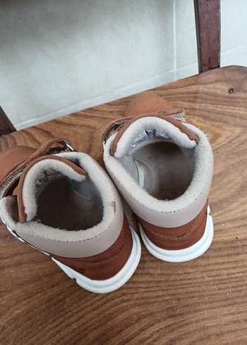 satış yok Ayak bileğim kırık amaliyatlıyım dışarı çıkamıyorum - Görsel 4