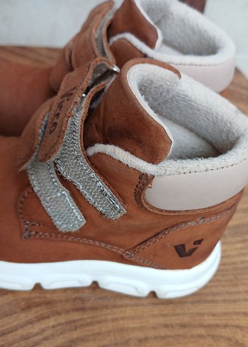 satış yok Ayak bileğim kırık amaliyatlıyım dışarı çıkamıyorum - Görsel 7