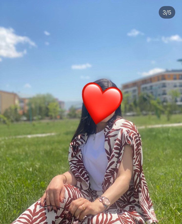 Bohem Tarz Kırmızı Batik Desenli Midi Kimono - Görsel 2