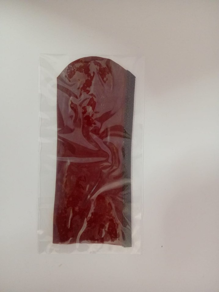 Yenilebilir iç çamaşırı - Görsel 2