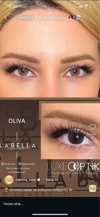Lens labella
