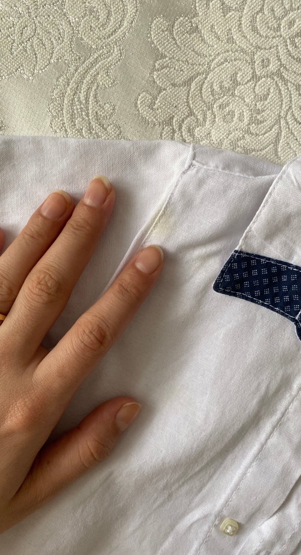 Düğmeli Vintage Bebek Erkek Body - Görsel 2