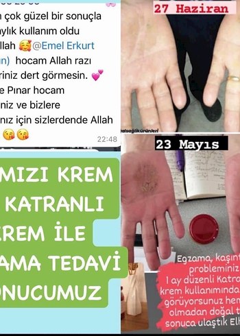 Kırmızı Kuşburnu ve Menekşe Bitkisel Karışım - Görsel 4