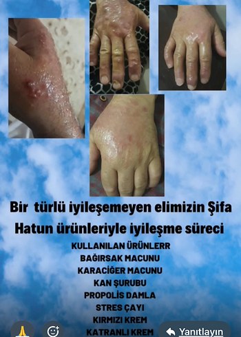 Kırmızı Kuşburnu ve Menekşe Bitkisel Karışım - Görsel 5