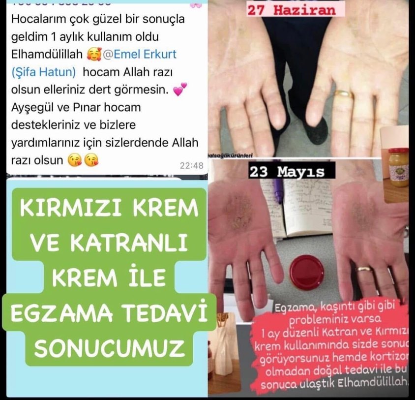 Kırmızı Kuşburnu ve Menekşe Bitkisel Karışım - Görsel 4