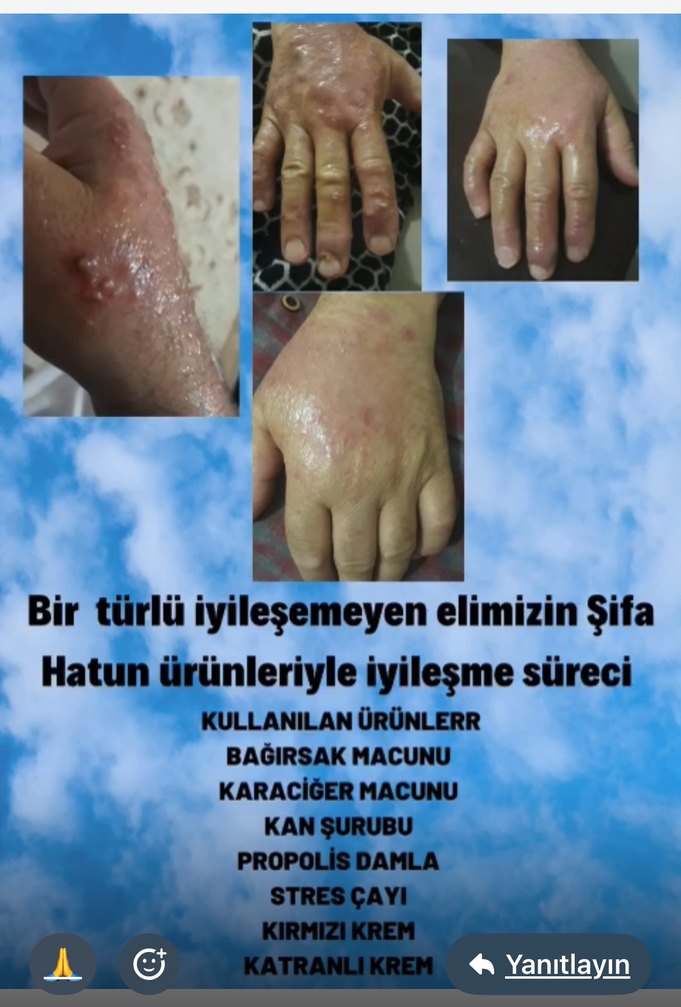 Kırmızı Kuşburnu ve Menekşe Bitkisel Karışım - Görsel 5