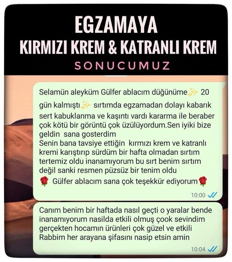 Sifa Hatun Kırmızı Kuşburnu ve Menekşe Yağlı Bitkisel Karışım - Görsel 5