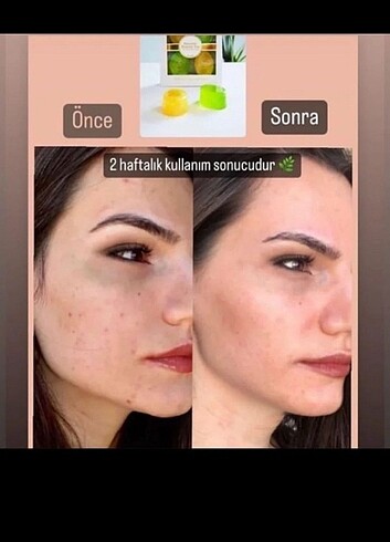 Diğer Kozmetik
