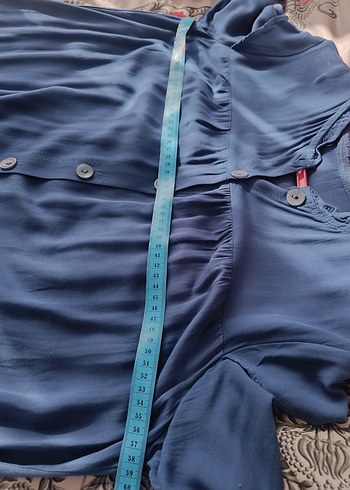 Mavi Düğmeli Uzun Kollu ferace elbise - Görsel 6