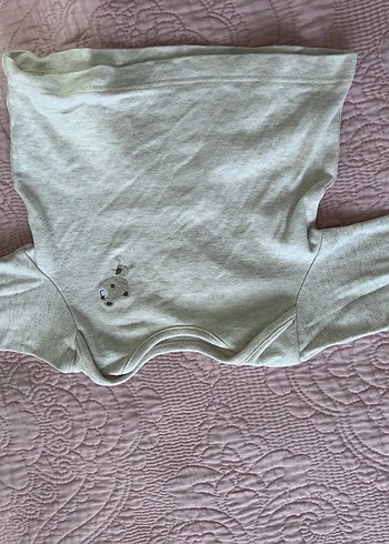 Yeni doğan hafif lekeli - Görsel 3