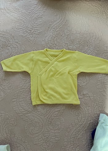 Yeni doğan hafif lekeli - Görsel 2