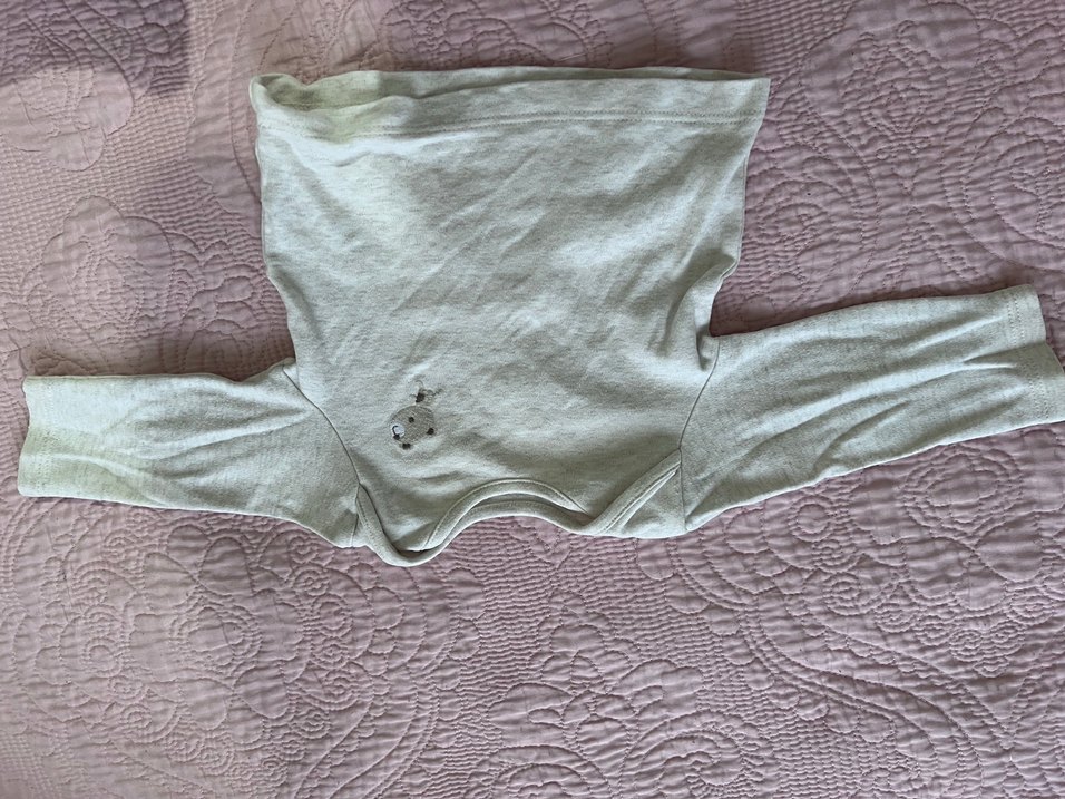 Yeni doğan hafif lekeli - Görsel 3