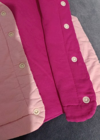 Kız Çocuk Pembe Düğmeli Yelek - Görsel 7