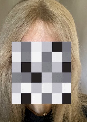 bebek kumralı gerçek saç tepelik - Görsel 4