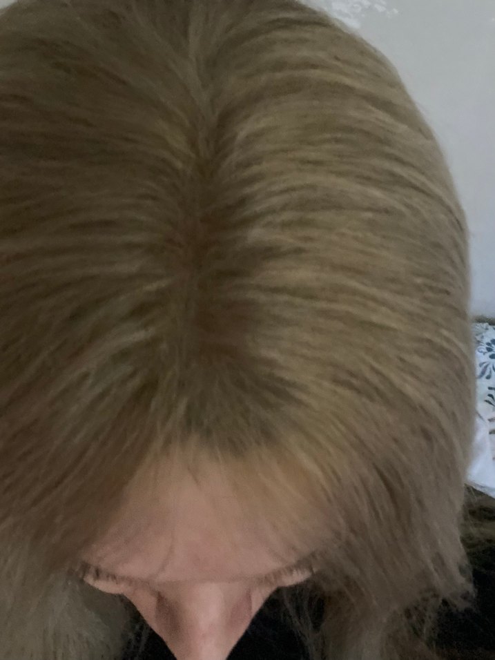 bebek kumralı gerçek saç tepelik - Görsel 2