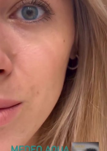 mavi lens - Görsel 2