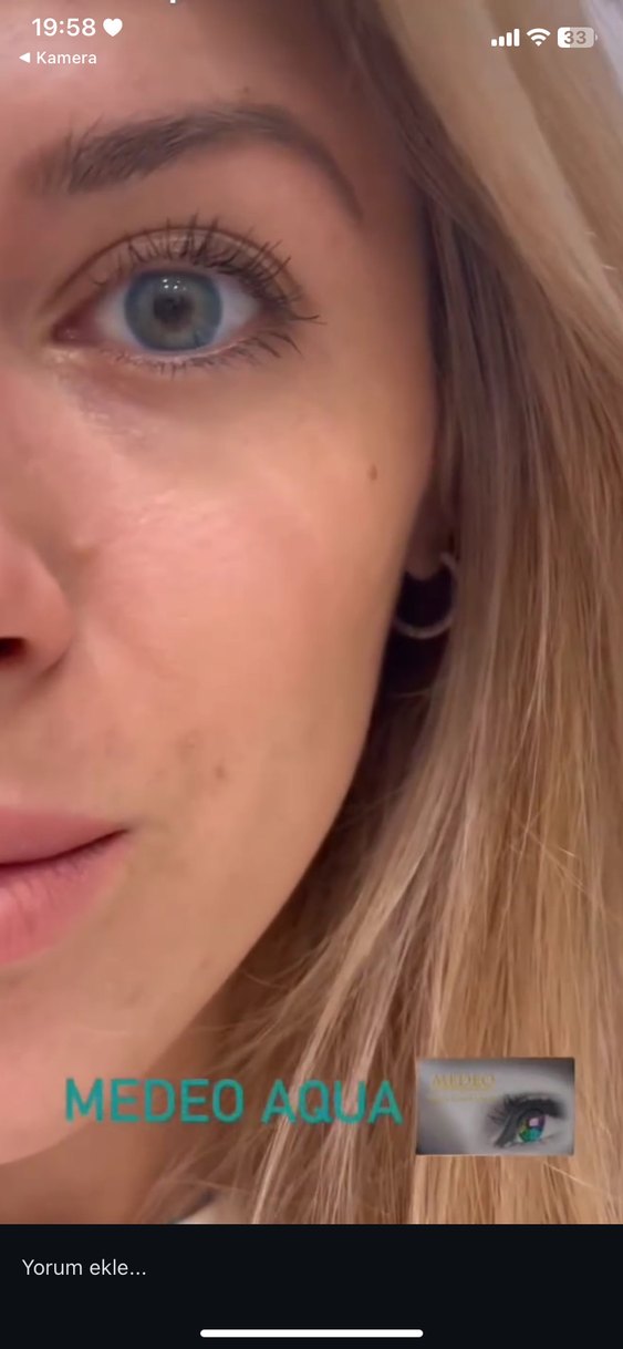 mavi lens - Görsel 2