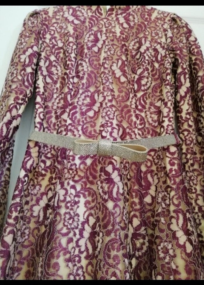 Dantel elbise - Görsel 4