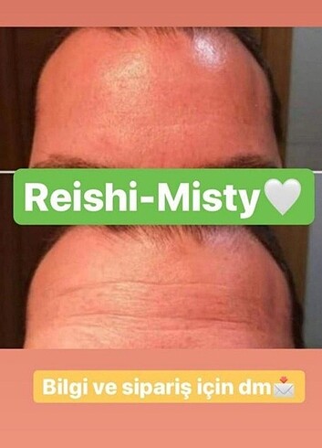 Botoks sprey - Görsel 2