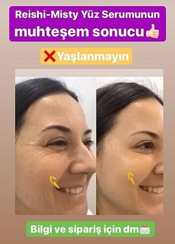 Botoks sprey - Görsel 3