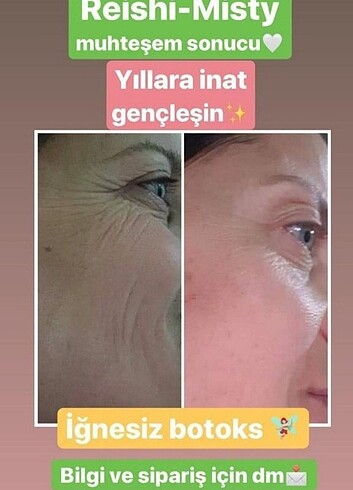 Botoks sprey - Görsel 4