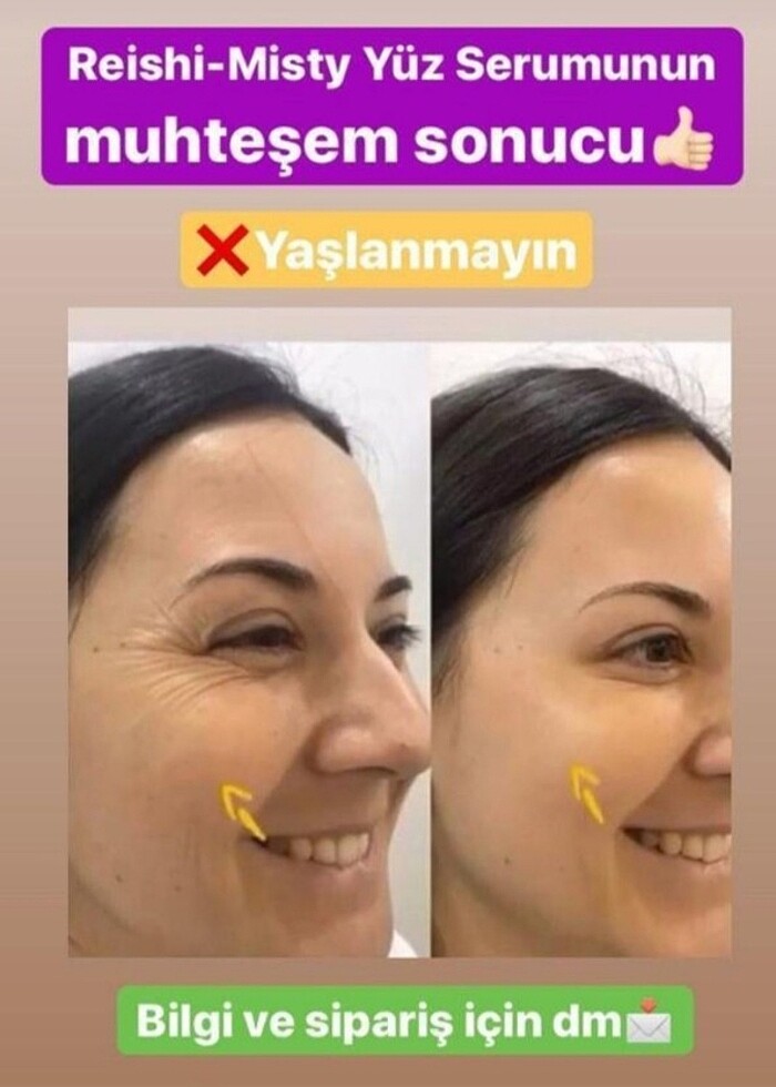 Botoks sprey - Görsel 3