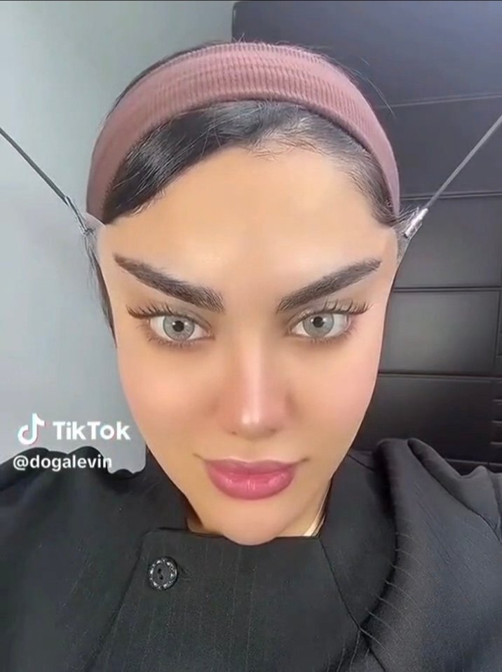 Yuz Kaş gerdirme banti (20li) - Görsel 2