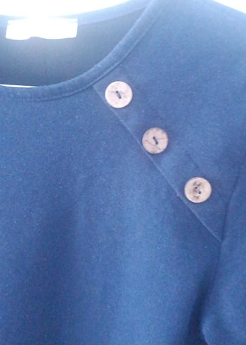 Düğmeli Lacivert Tunik - Görsel 2