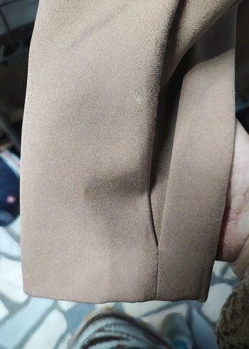 kolunda nokta nokta beyazlıklar var sadece - Görsel 3