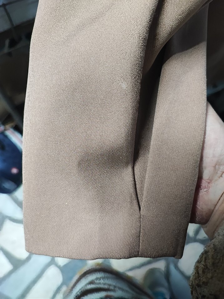 kolunda nokta nokta beyazlıklar var sadece - Görsel 3