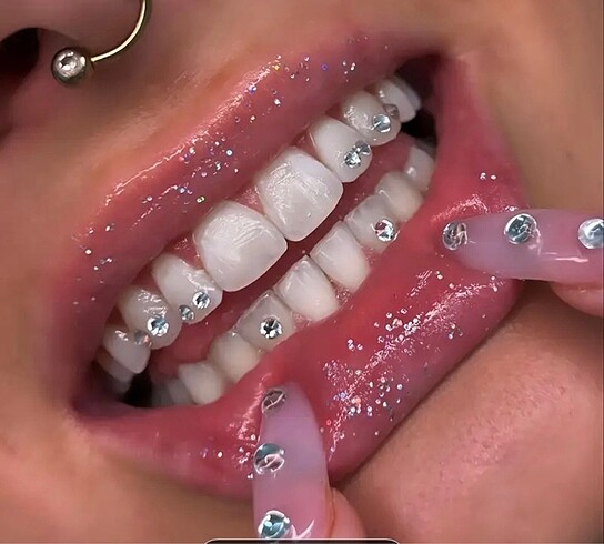 Diğer Taşlı grillz diş taşı