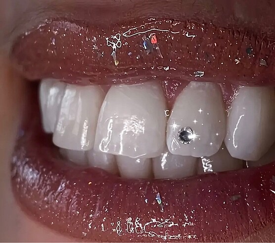 Taşlı grillz diş taşı