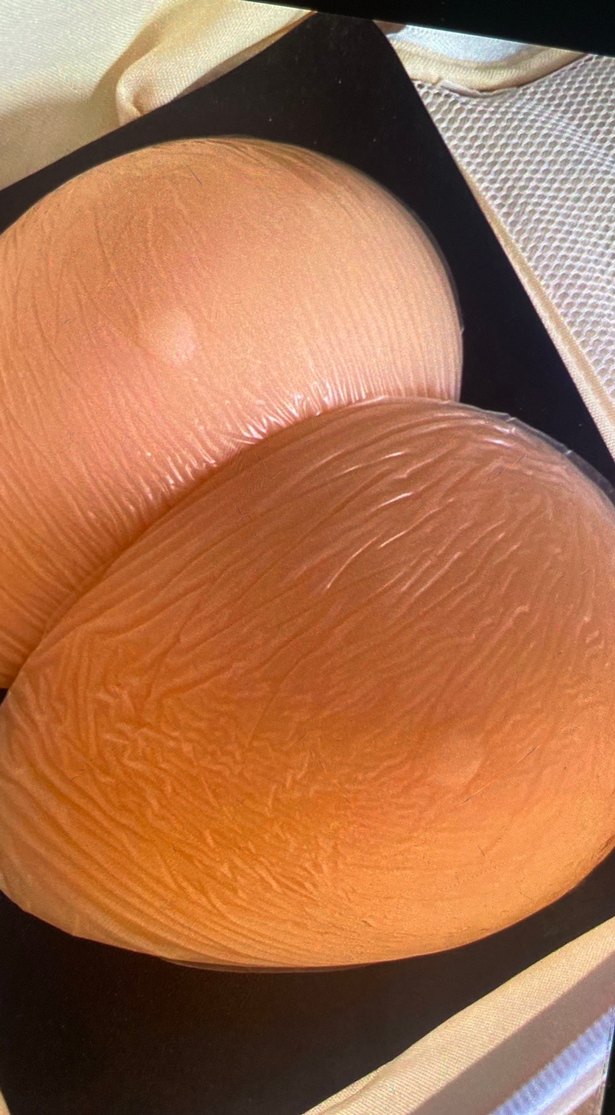 Bej Göğüs Pedi Çiftli Paket medikal ürün - Görsel 4