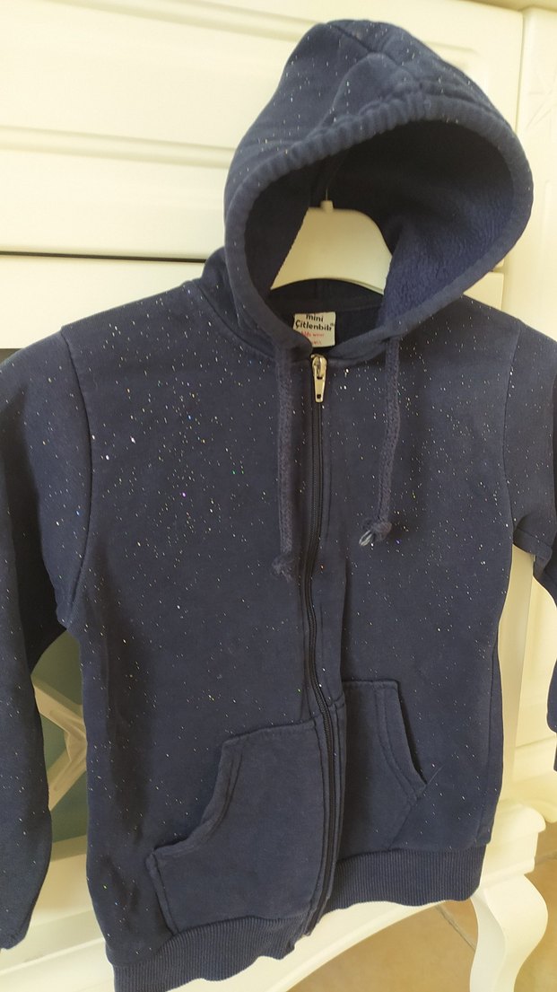 kolun arkasında ufak göze batmiyacak soluk var - Görsel 2