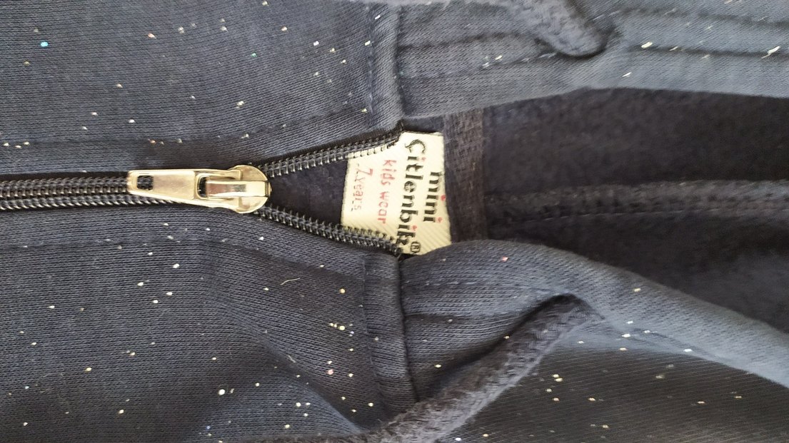 kolun arkasında ufak göze batmiyacak soluk var - Görsel 3