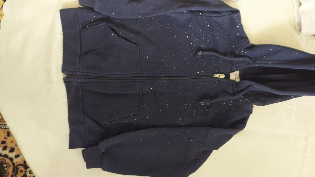 kolun arkasında ufak göze batmiyacak soluk var - Görsel 5