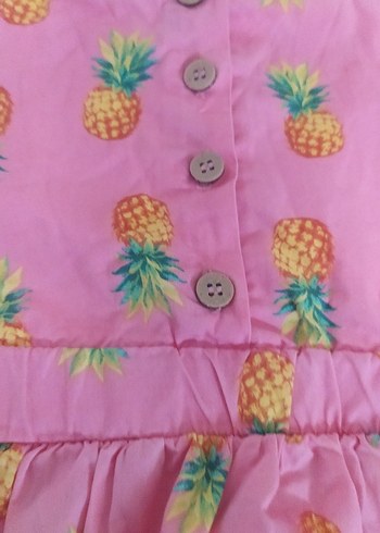 Pembe Ananas Desenli Kız Çocuk Elbisesi - Görsel 5