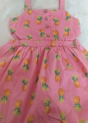 Pembe Ananas Desenli Kız Çocuk Elbisesi - Görsel 4