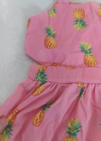 Pembe Ananas Desenli Kız Çocuk Elbisesi - Görsel 3