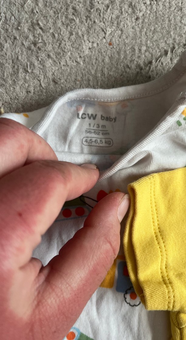 Sarı ve Desenli Kısa Kollu Bebek Body - Görsel 2