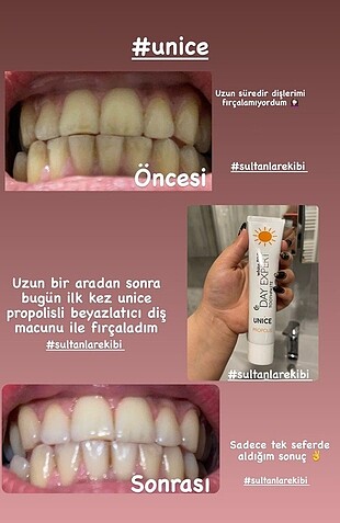 Beden Unice beyazlatıcı diş macunu