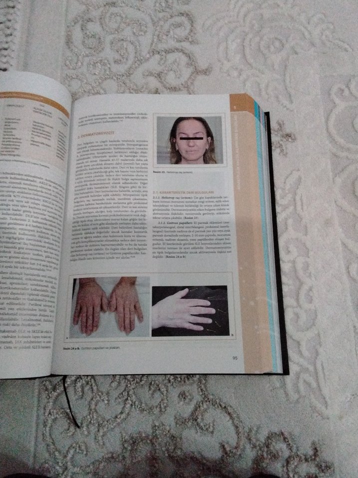 Klinik Romatoloji Sağlık Kitabı - Görsel 5