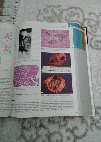 Cerrahi Patolojisi - Juan Rosai - Görsel 3