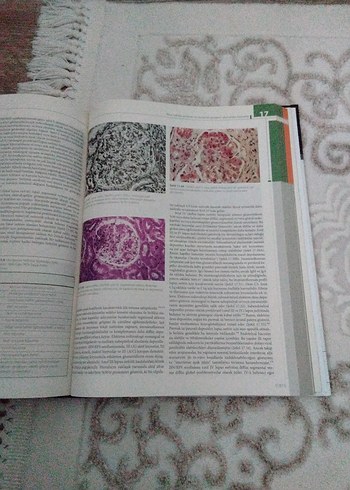 Cerrahi Patolojisi - Juan Rosai - Görsel 5