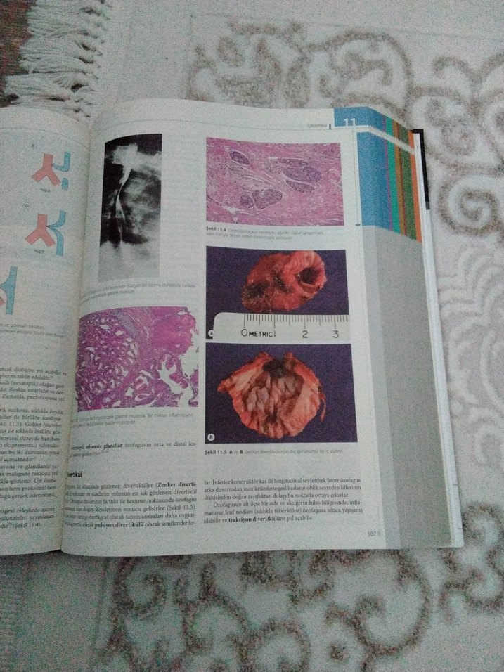 Cerrahi Patolojisi - Juan Rosai - Görsel 3