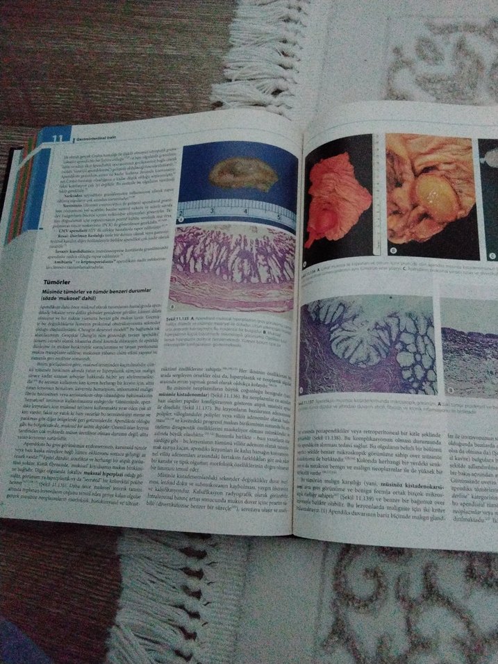 Cerrahi Patolojisi - Juan Rosai - Görsel 4