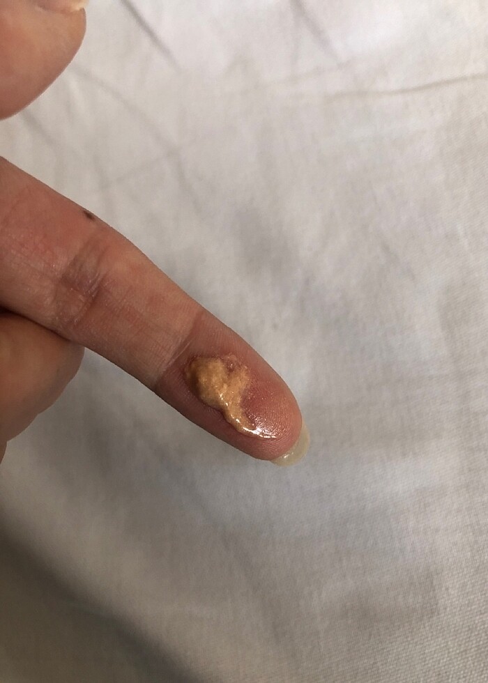 Yves rocher baz - Görsel 3